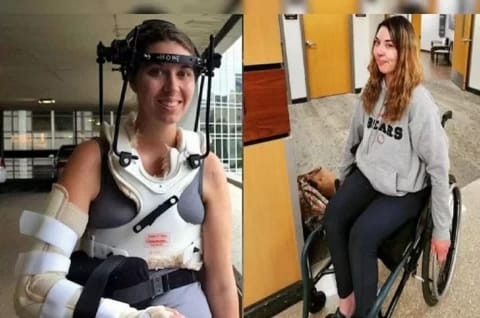 Megan King, wanita AS yang cedera putus kepala bagian dalam saat olahraga. Foto: Repro Sindonews.