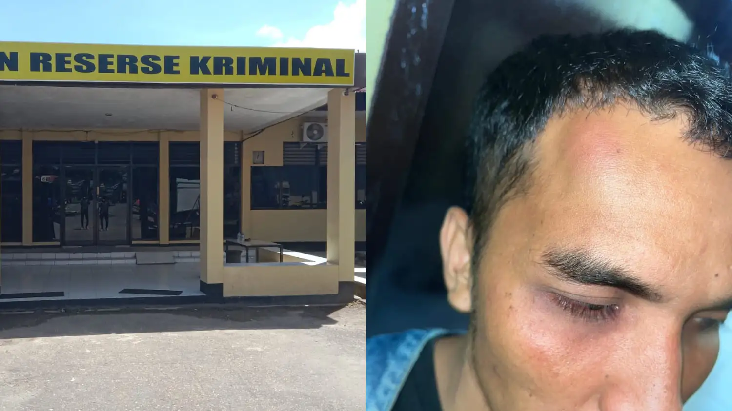 Proses hukum kasus penganiayaan terhadap Ading Wijaya (28) dinilai mandek oleh keluarga korban. Foto: Ist.